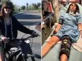 Nina Dobrev Updates Fans on Recovery Following E-Bike Accident